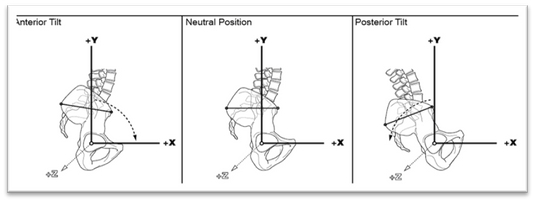 Diagram 3: Pelvic tilt comparison